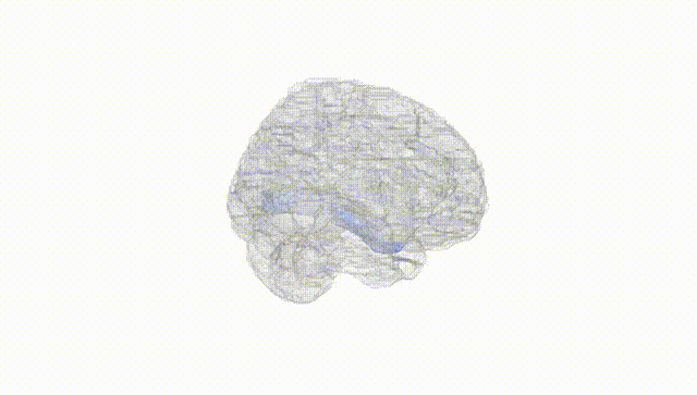 Full Brain White