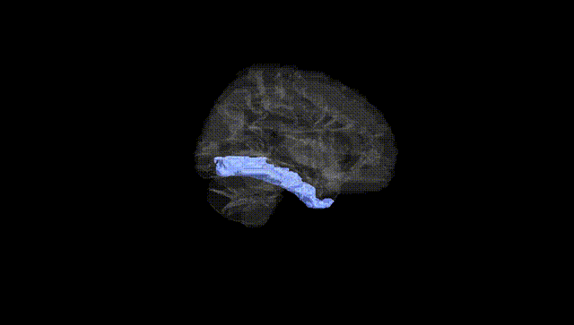 Hemisphere Black