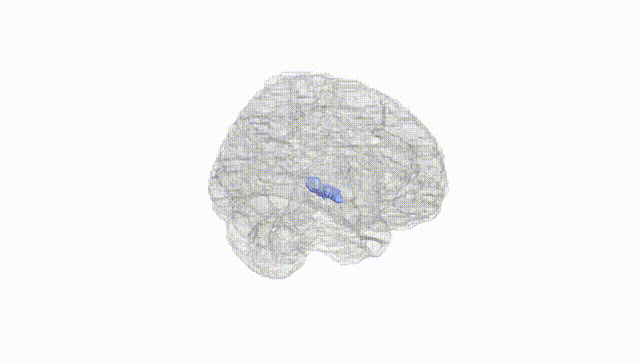 Full Brain White