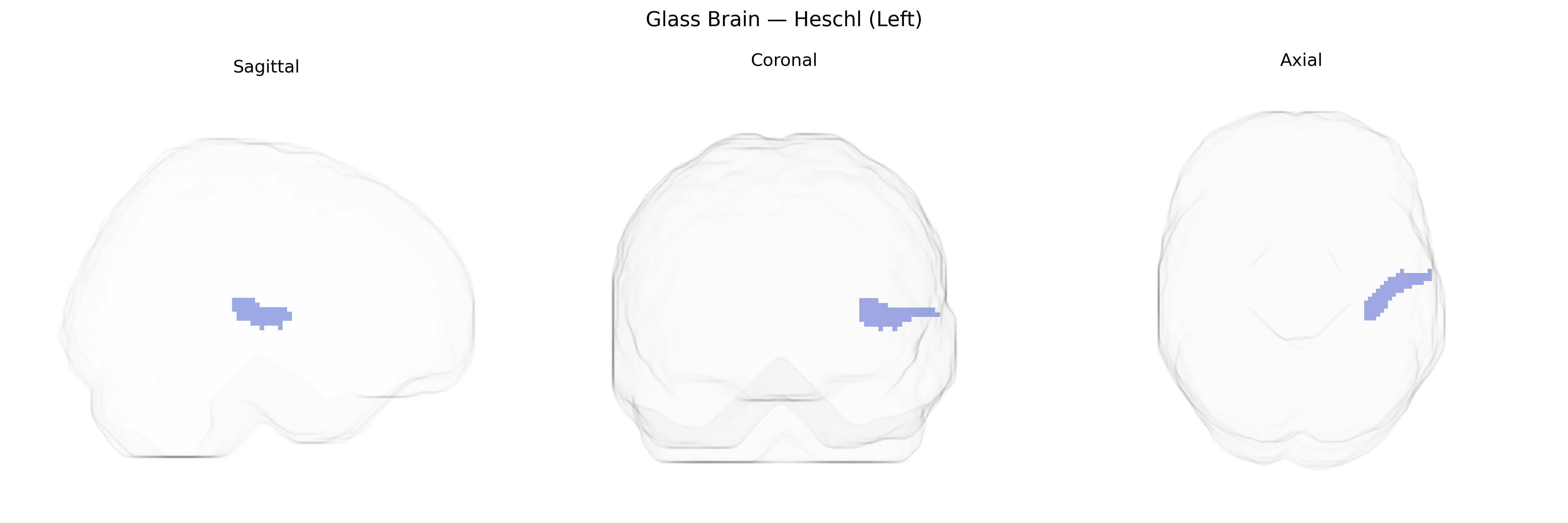 Triplanar Ghost Brain