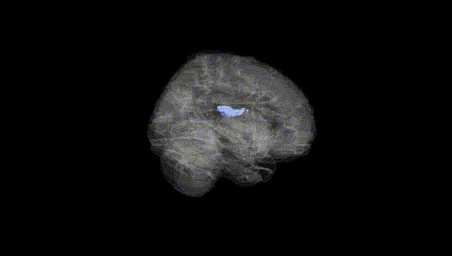 Full Brain Black