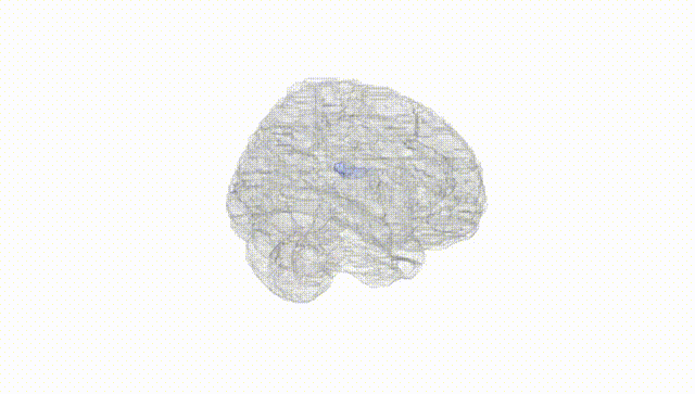 Full Brain White