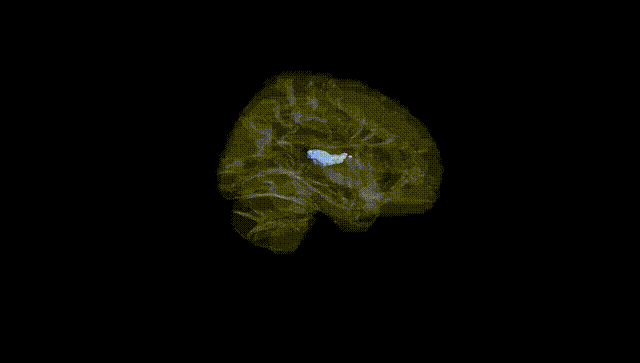 Hemisphere Black