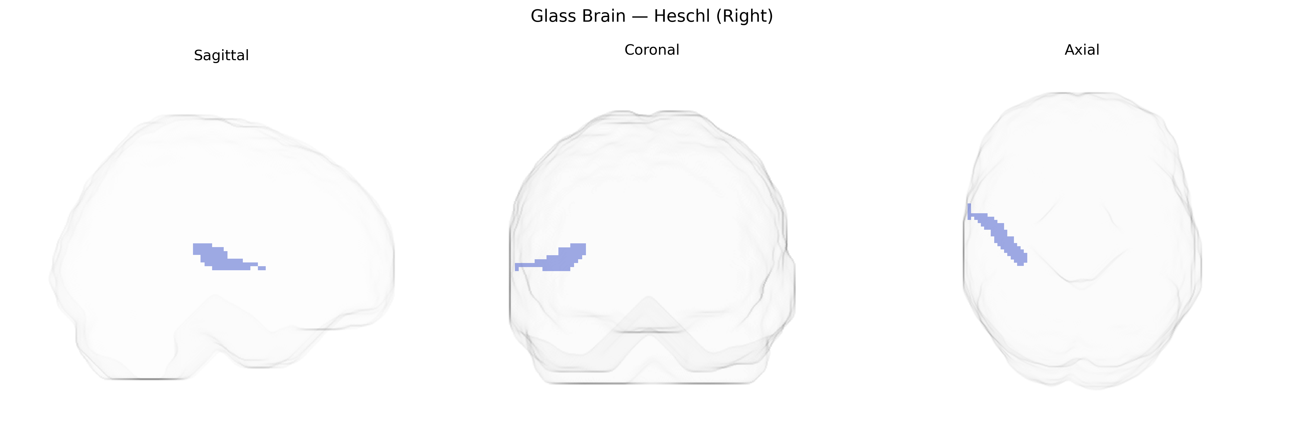 Triplanar Ghost Brain