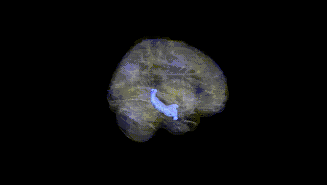 Full Brain Black