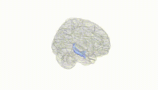 Full Brain White