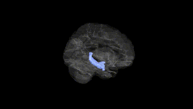 Hemisphere Black