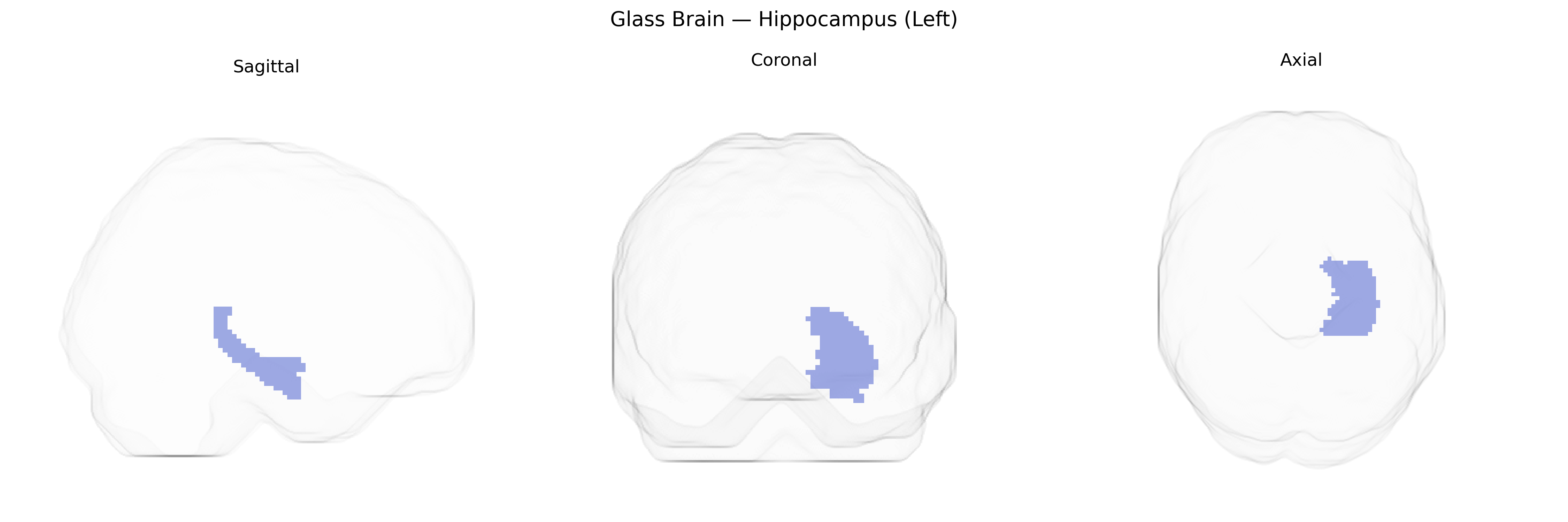 Triplanar Ghost Brain