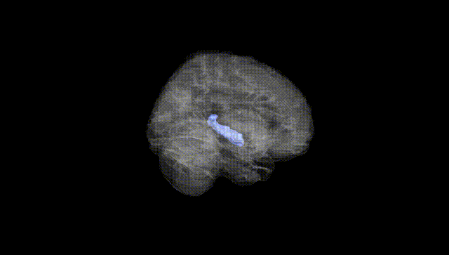 Full Brain Black