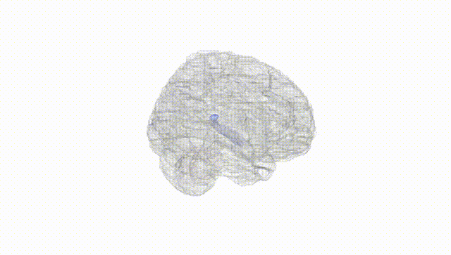 Full Brain White