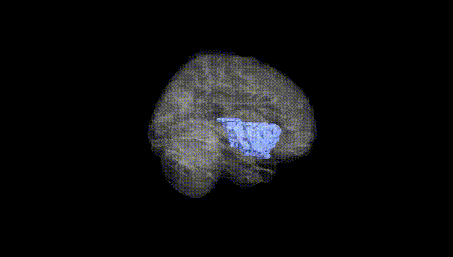 Full Brain Black