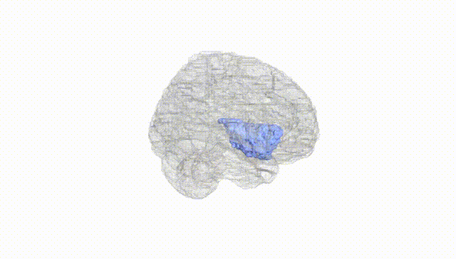 Full Brain White