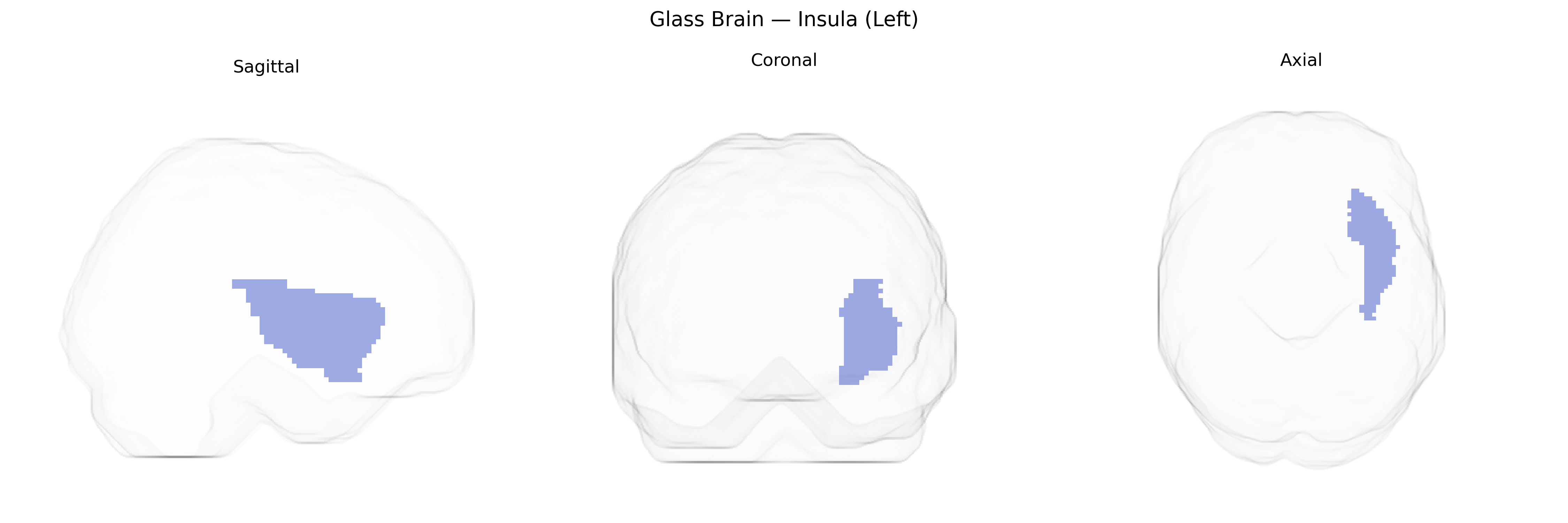 Triplanar Ghost Brain