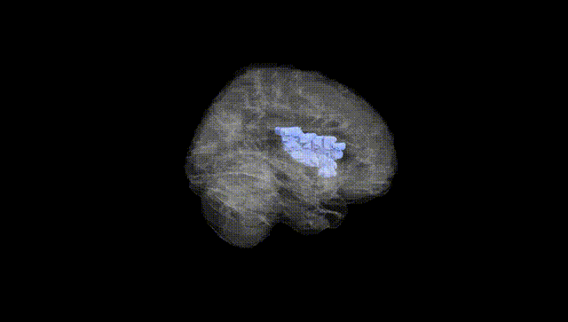 Full Brain Black