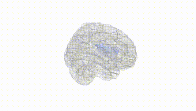 Full Brain White
