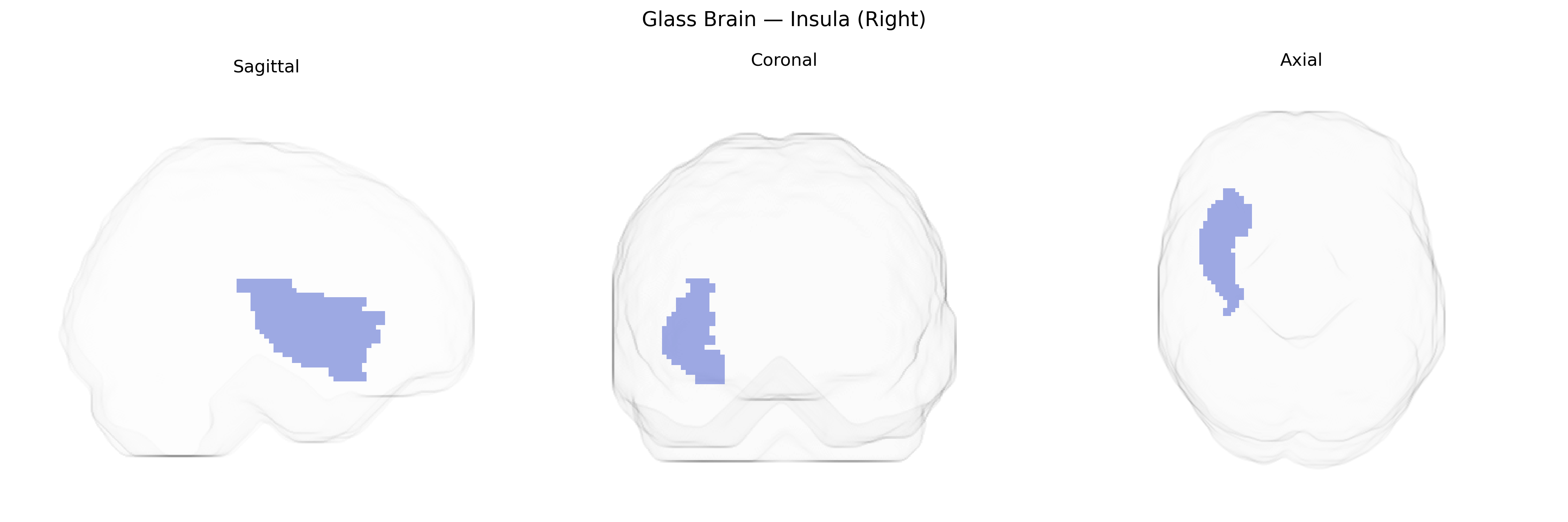 Triplanar Ghost Brain