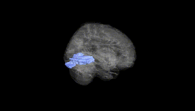 Full Brain Black
