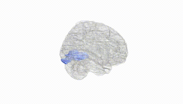 Full Brain White