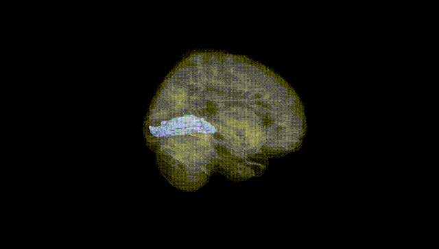 Full Brain Black