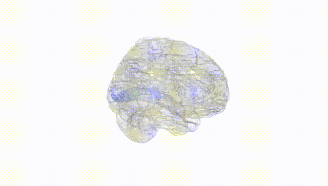 Full Brain White