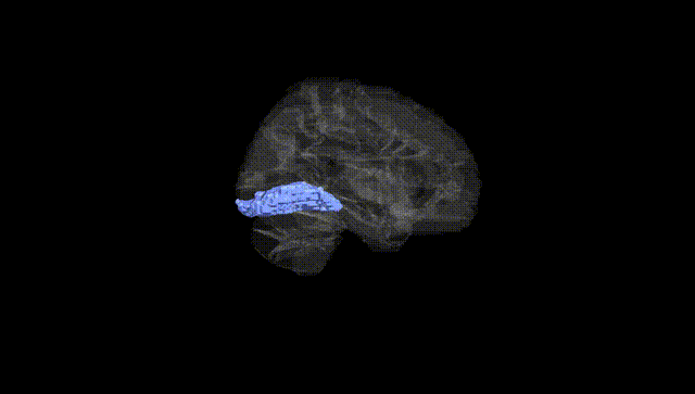 Hemisphere Black