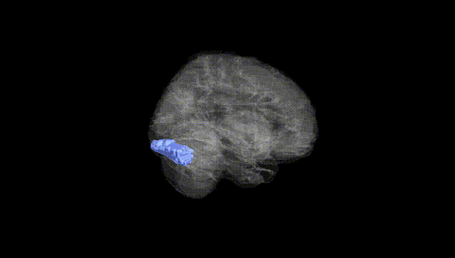 Full Brain Black