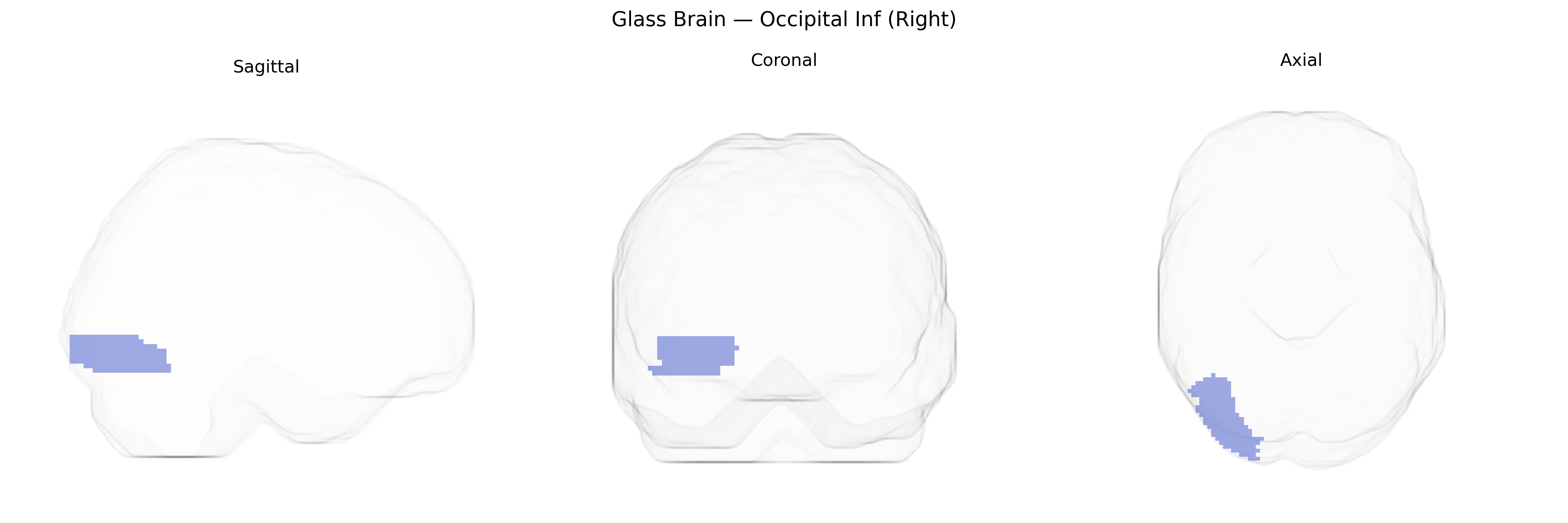 Triplanar Ghost Brain