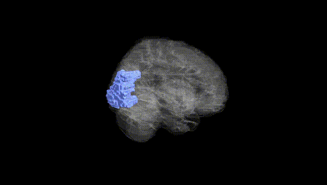 Full Brain Black