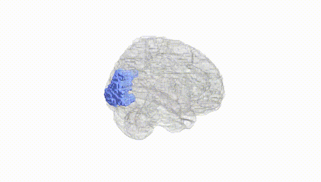 Full Brain White