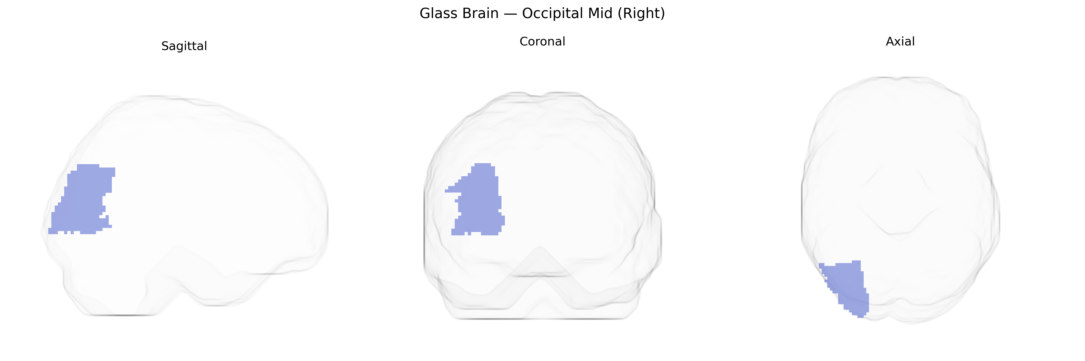 Triplanar Ghost Brain