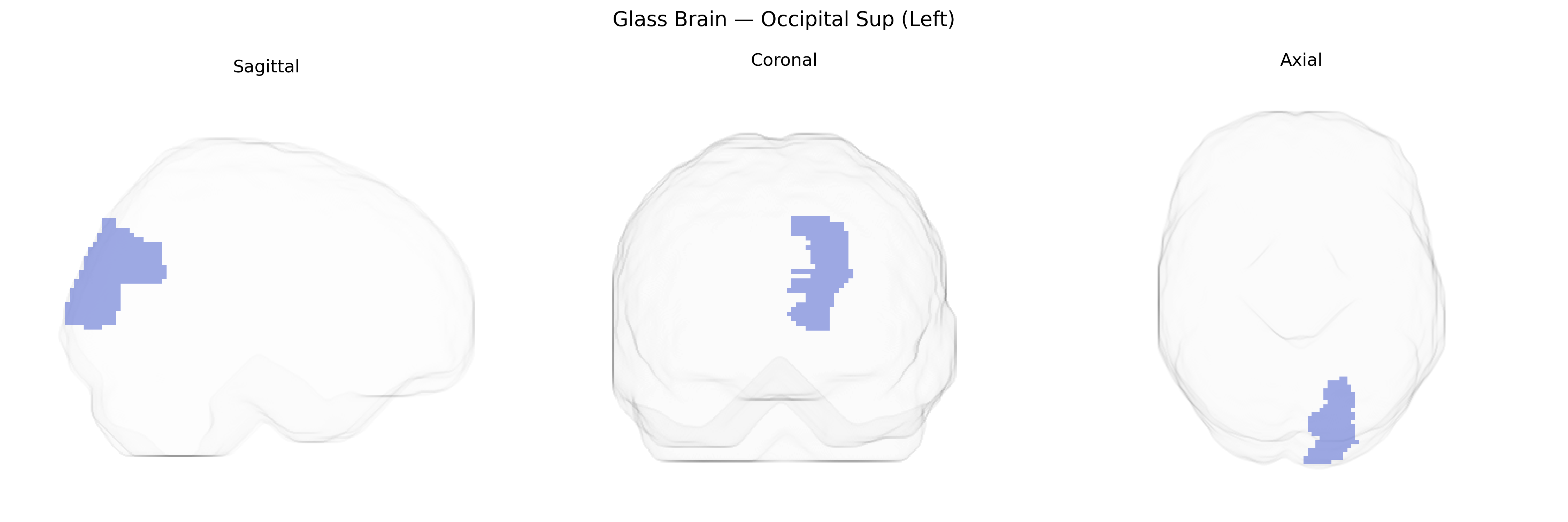 Triplanar Ghost Brain