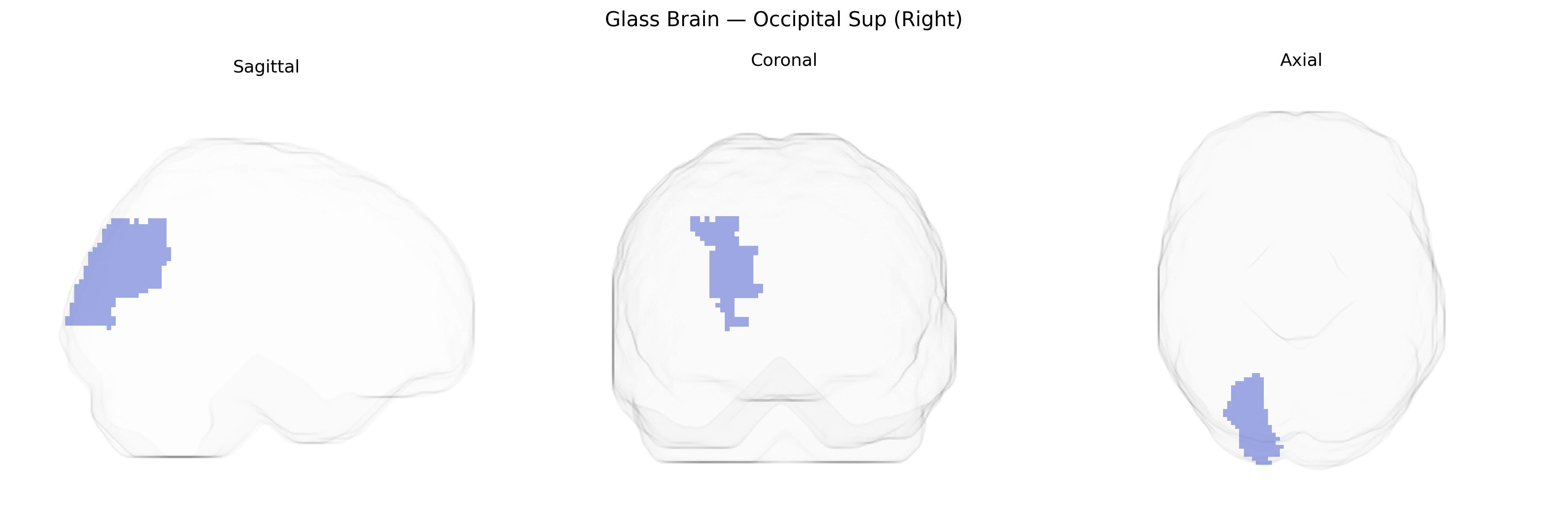 Triplanar Ghost Brain
