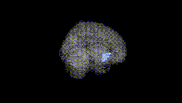 Full Brain Black