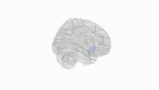 Full Brain White