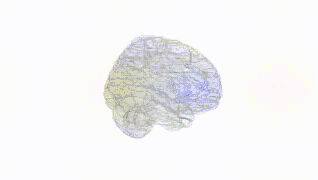 Full Brain White