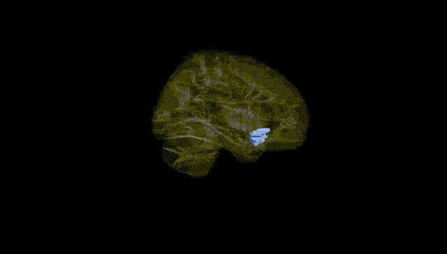 Hemisphere Black