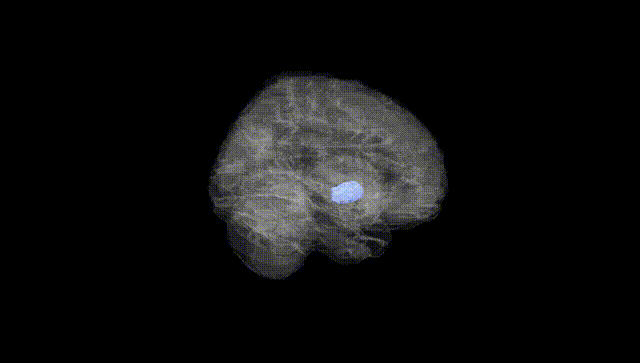 Full Brain Black