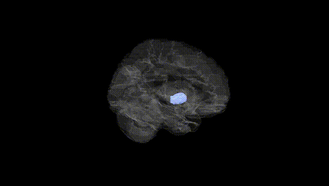 Hemisphere Black