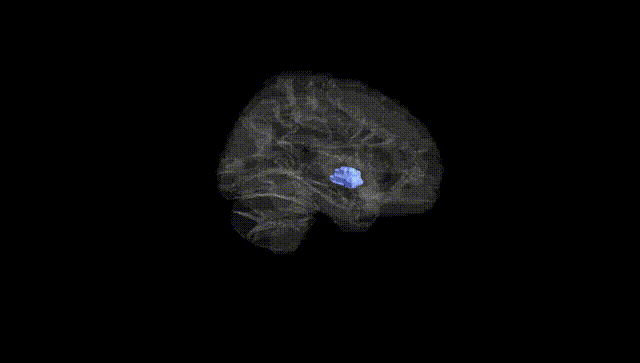 Hemisphere Black