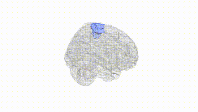 Full Brain White
