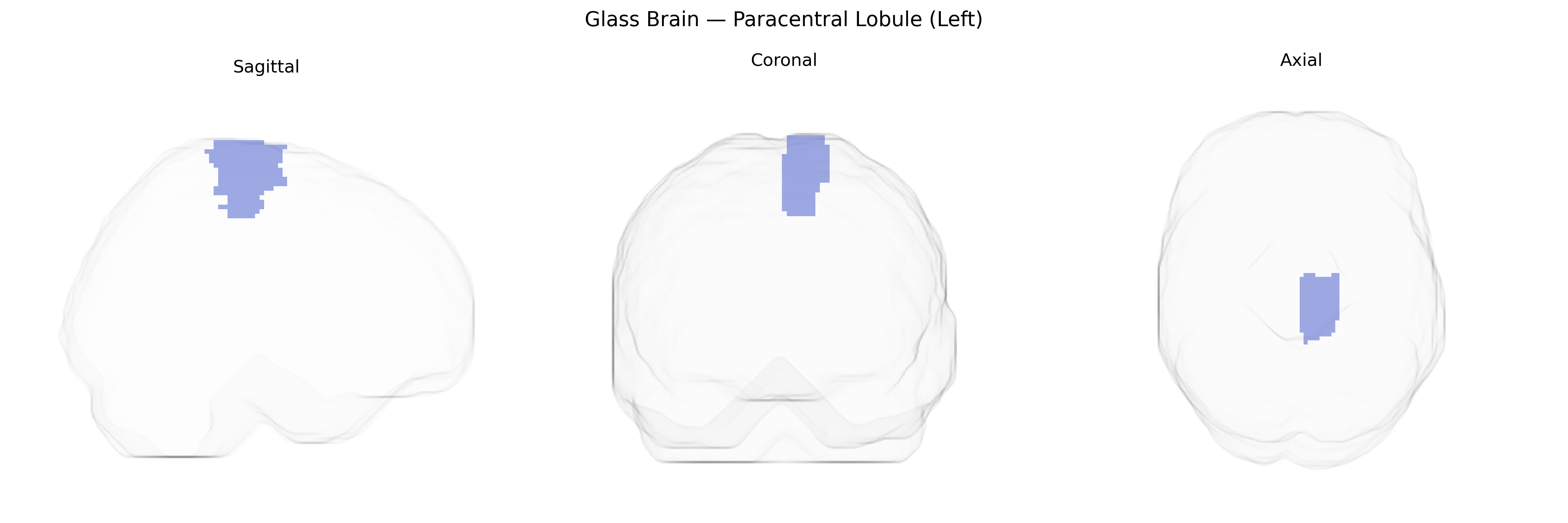 Triplanar Ghost Brain