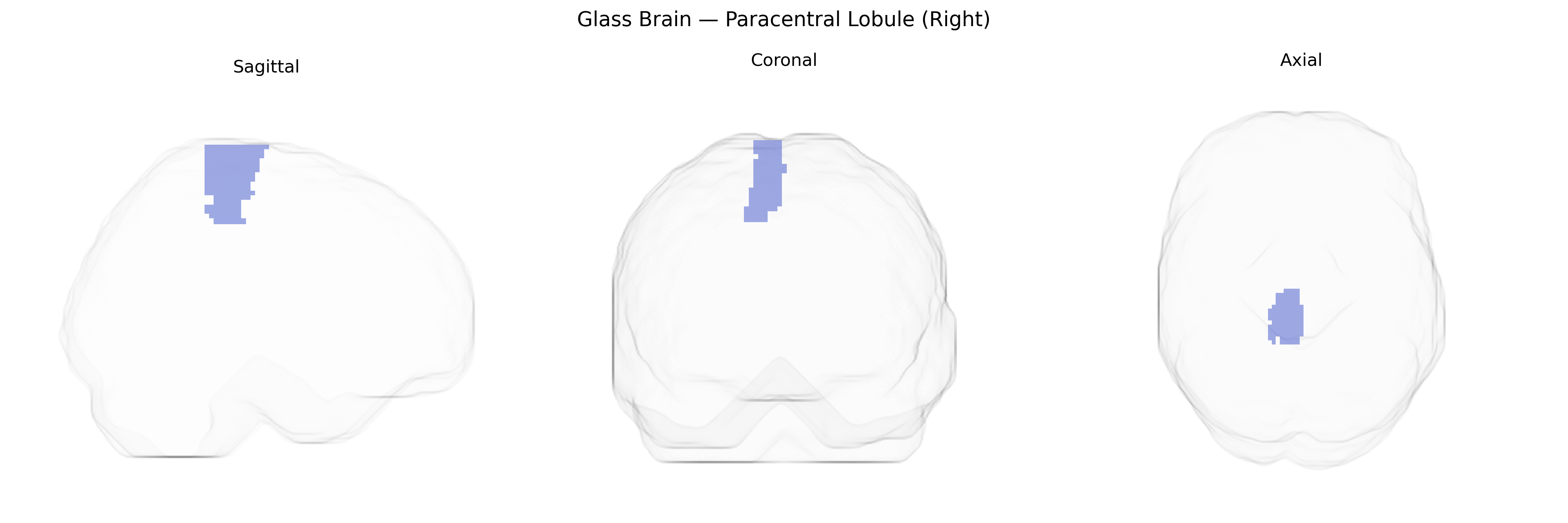 Triplanar Ghost Brain