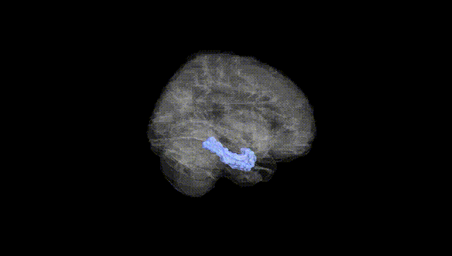 Full Brain Black