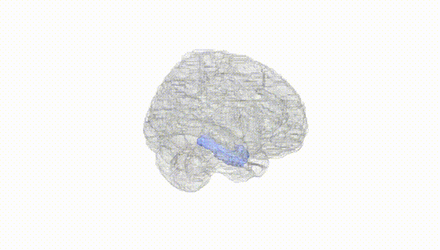 Full Brain White