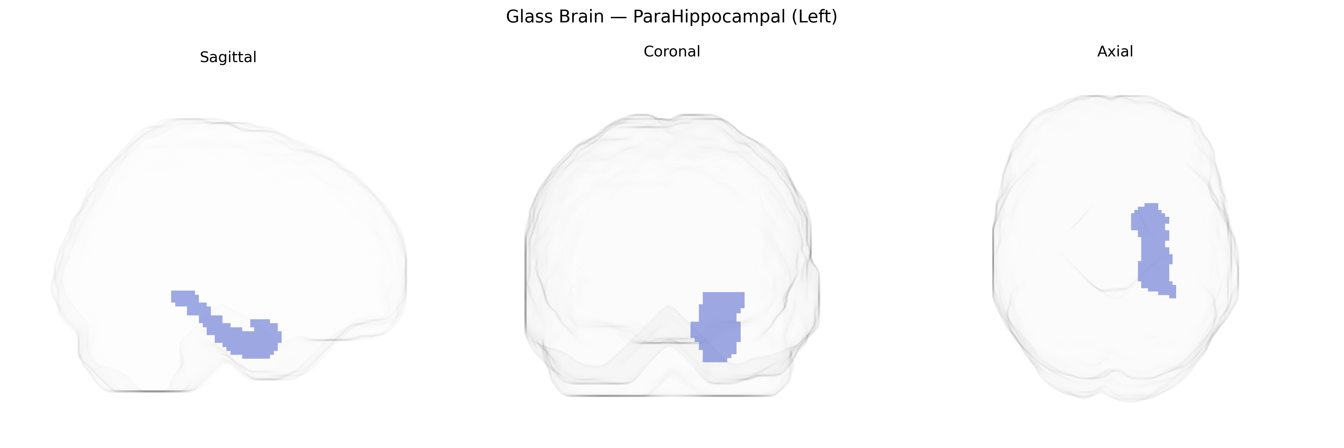 Triplanar Ghost Brain