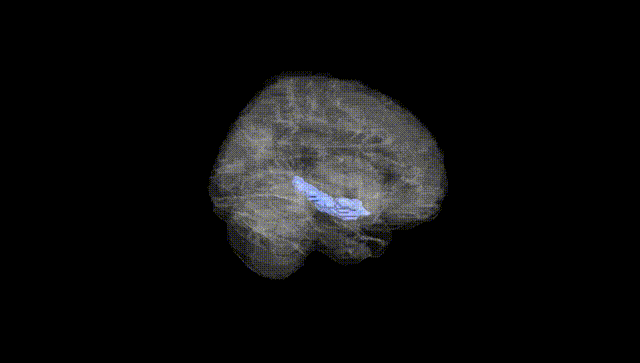 Full Brain Black