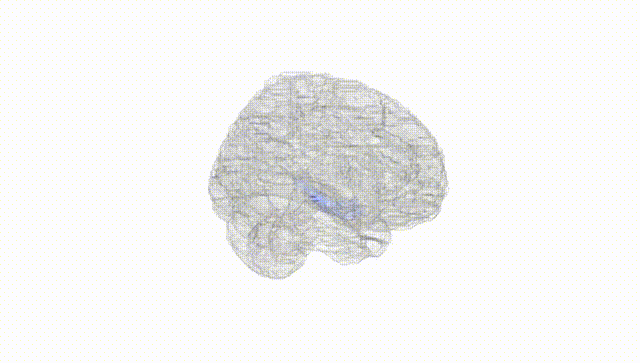 Full Brain White
