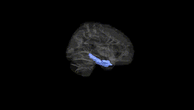 Hemisphere Black