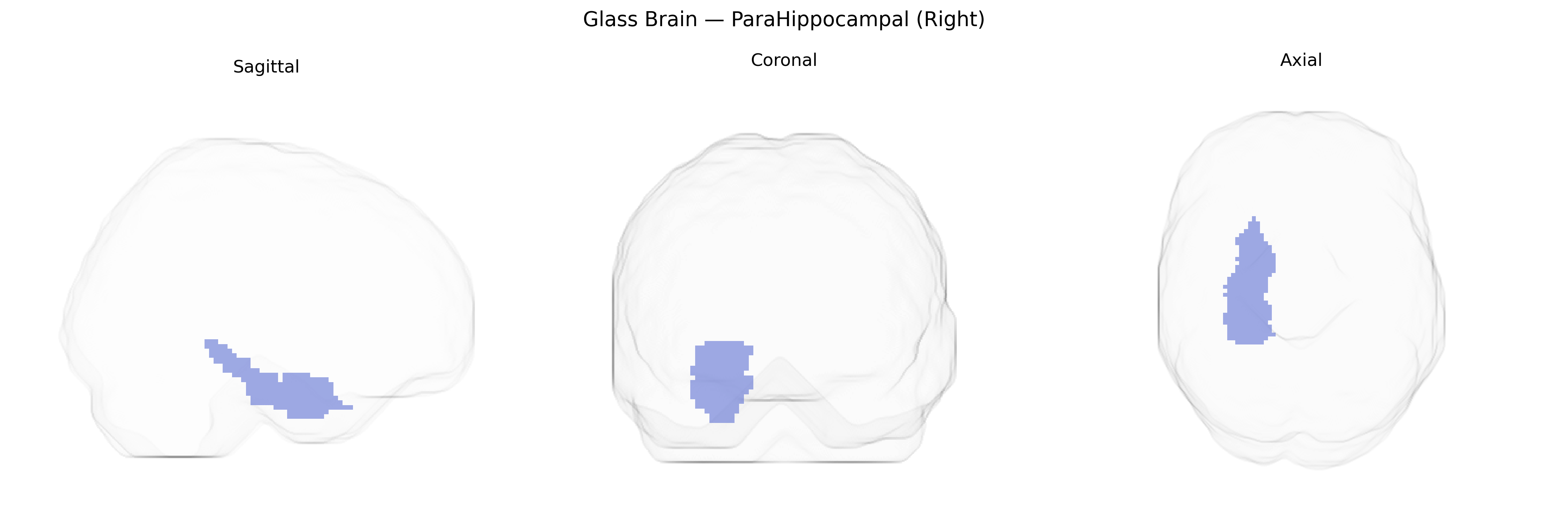 Triplanar Ghost Brain