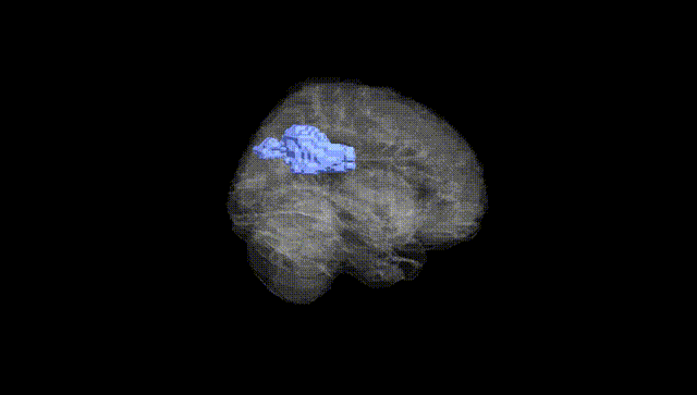 Full Brain Black
